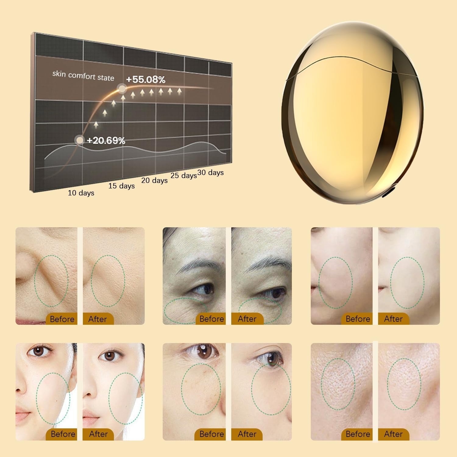 Electric collagen beauty device, colored light massage device